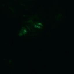 Satellite imagery of Skötkobben, AX