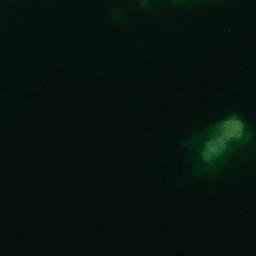 Satellite imagery of Österkobben, AX