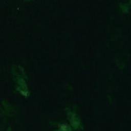 Satellite imagery of Bredkläpp, AX